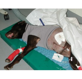 Catéter de Difusión 11cm