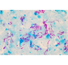 Tincion May-Grünwald 250ml