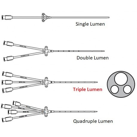 Triple Lumen
