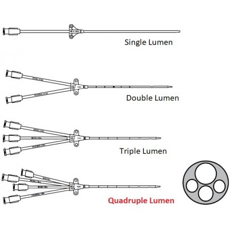 Quadruple Lumen